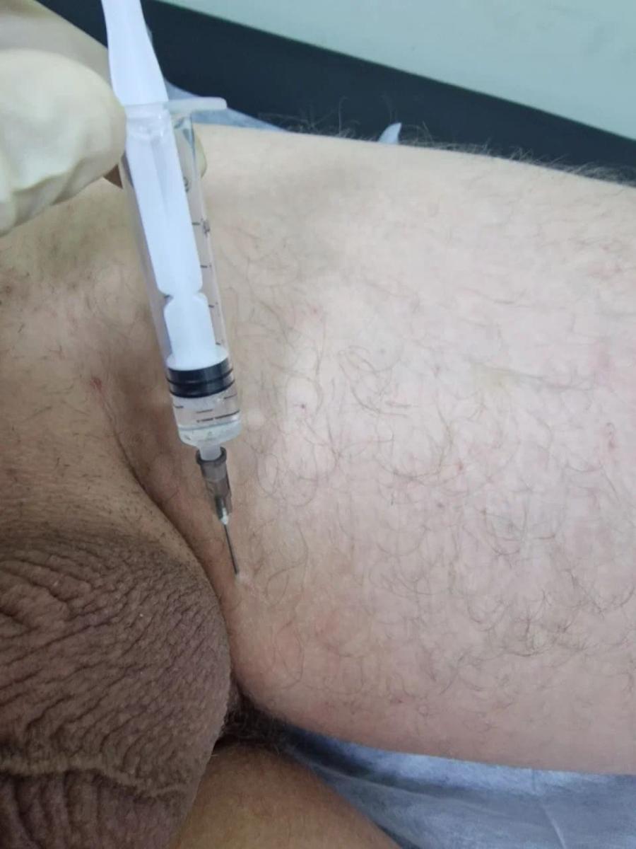 сифилис – сложное и коварное заболевание