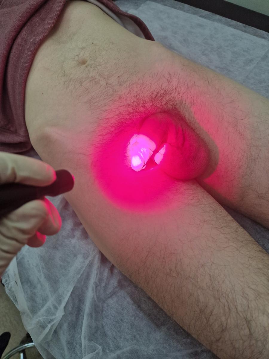 фотодинамика