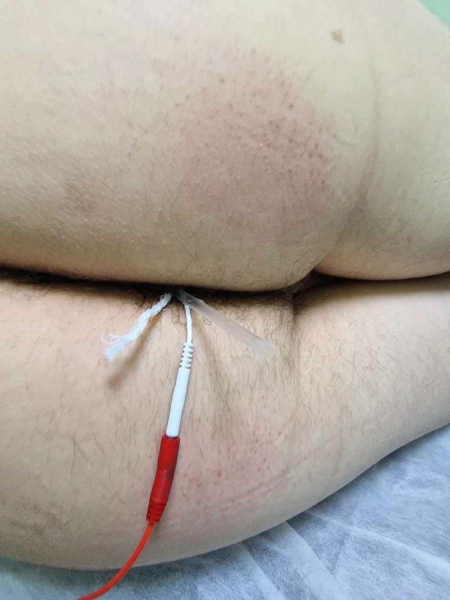 комбинация электрофореза и ударно-волновой терапии увт_2