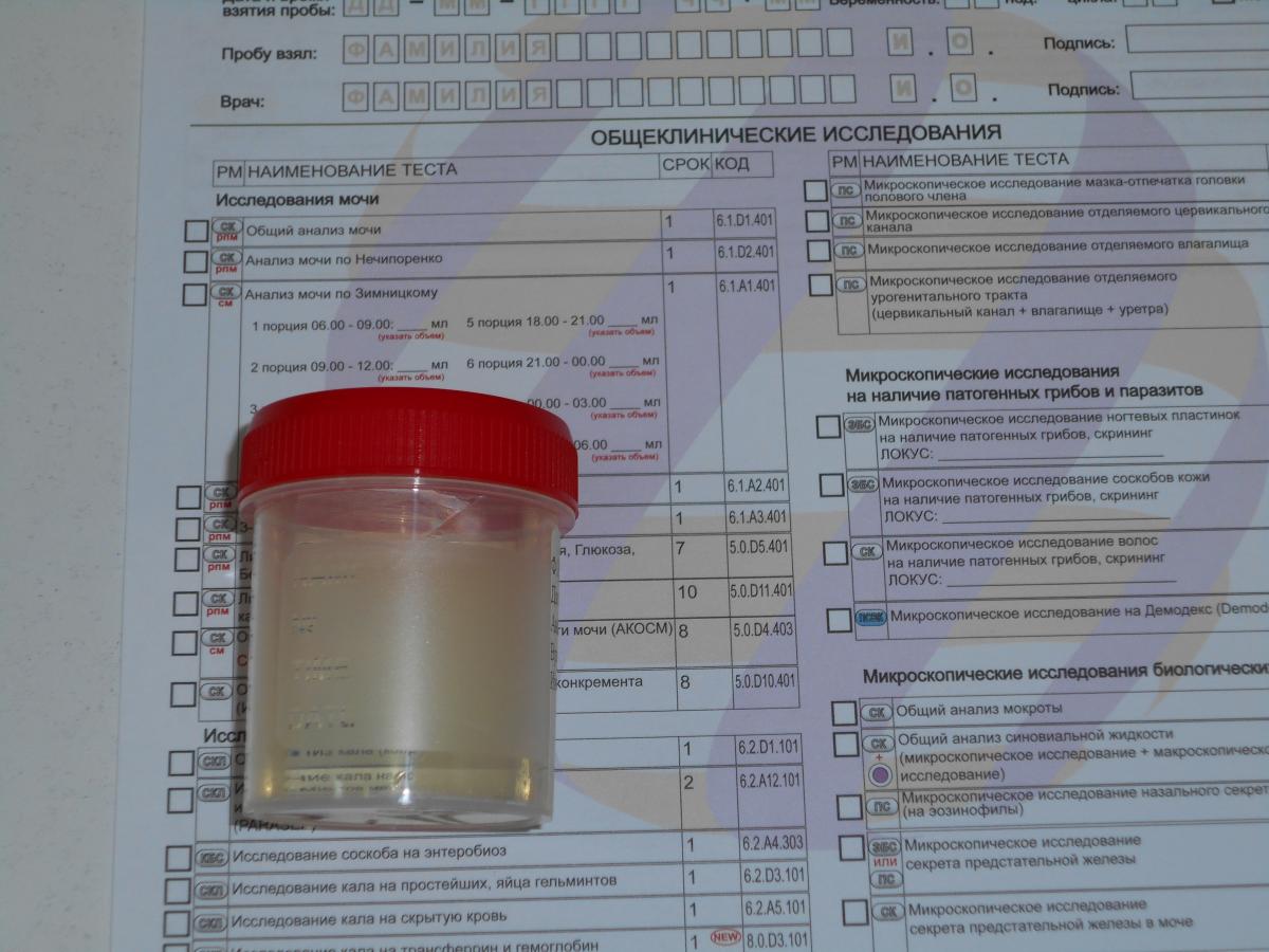 признаки конгестивного простатита