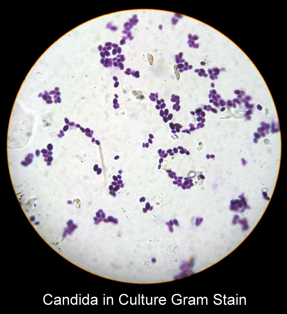 Микроскопия мазка на кандидоз