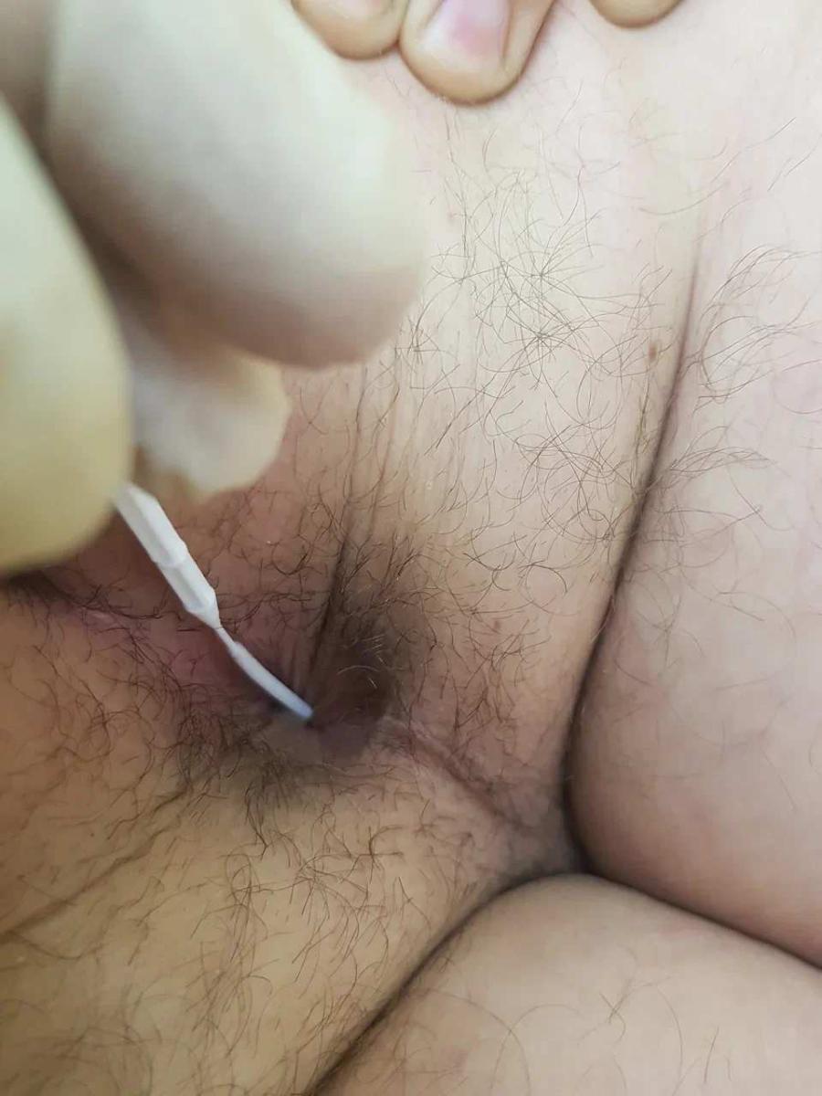 забор соскоба забор соскоба