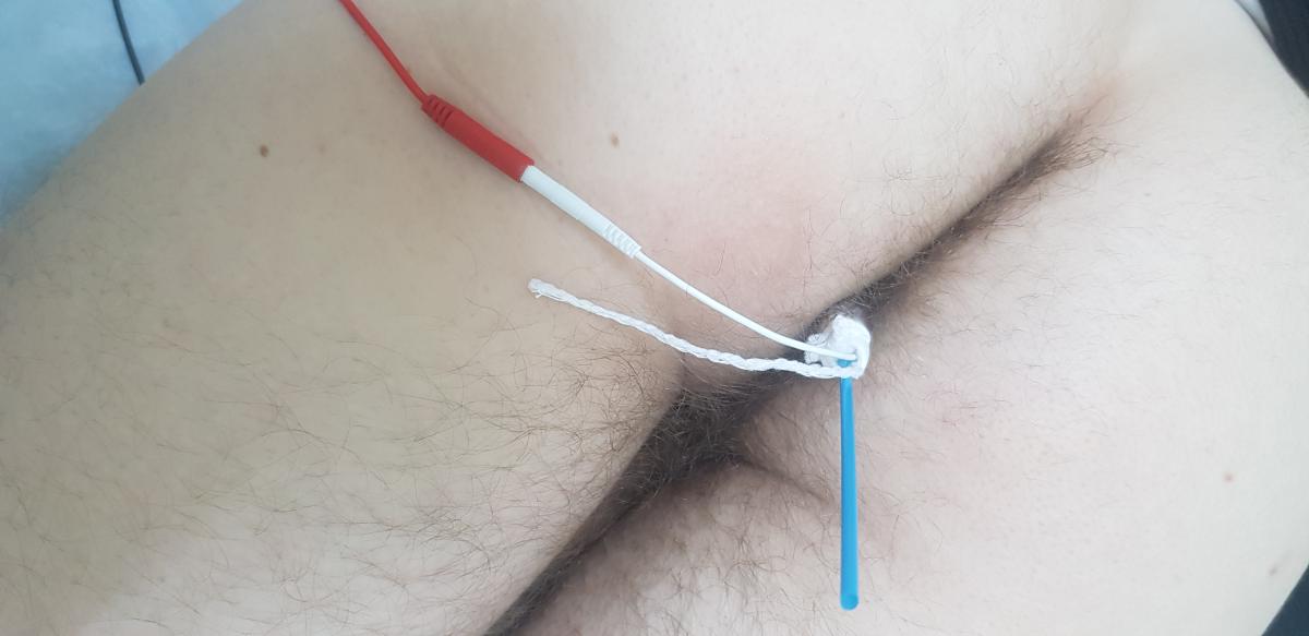 электрофорез