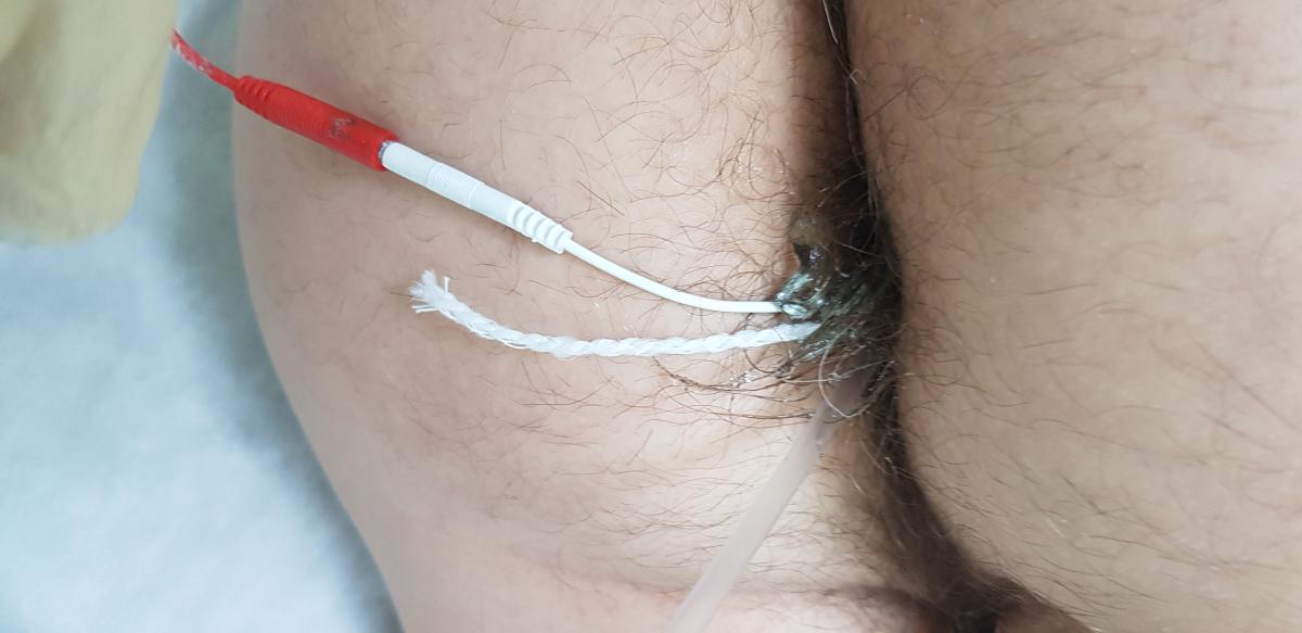 электрофорез