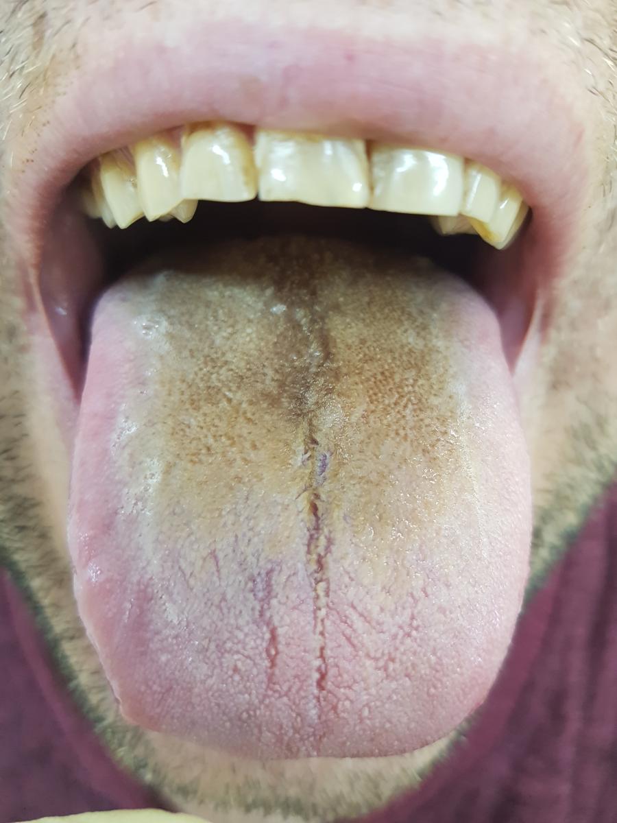 черный язык