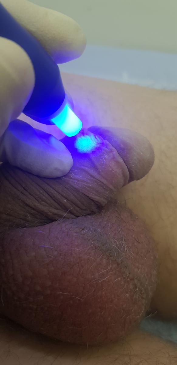 оксид азота