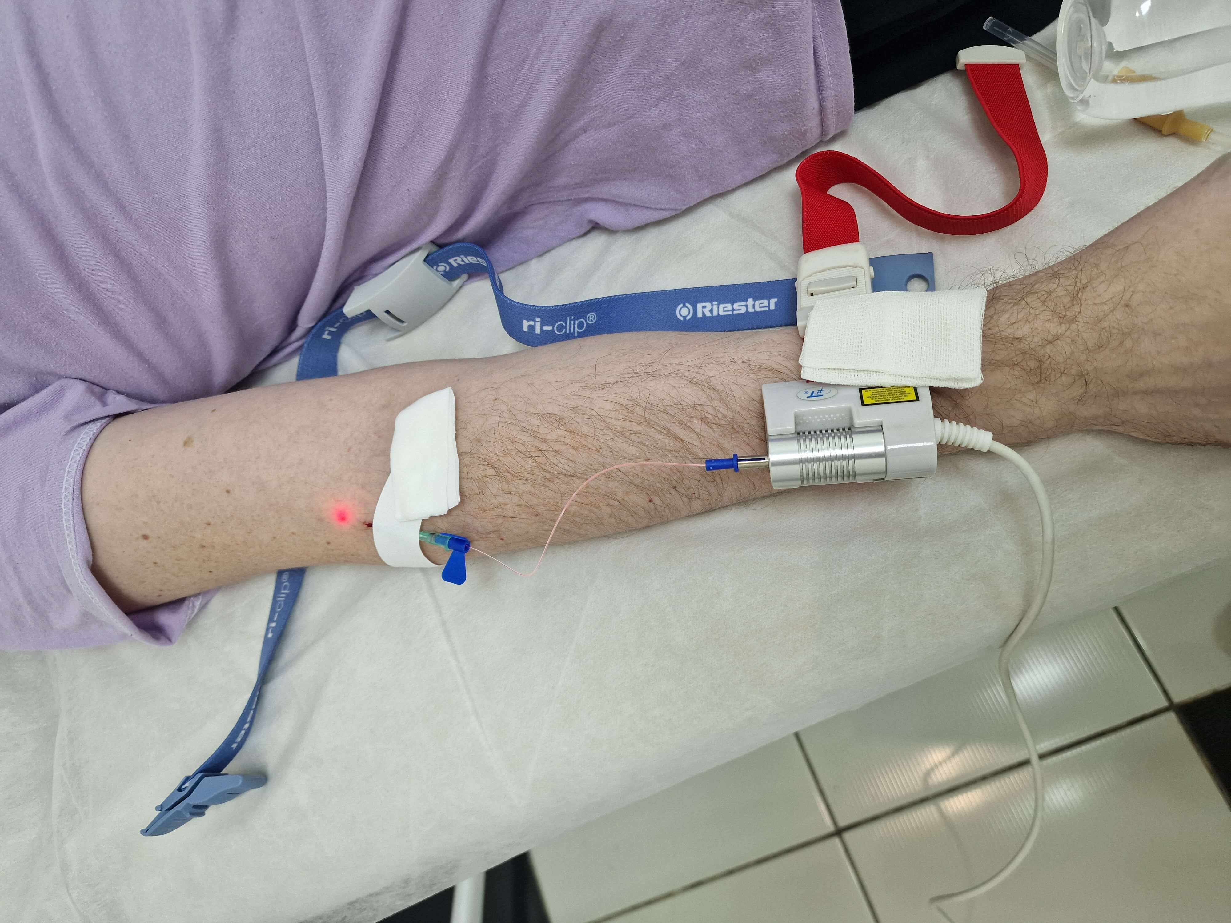 внутривенное облучение крови