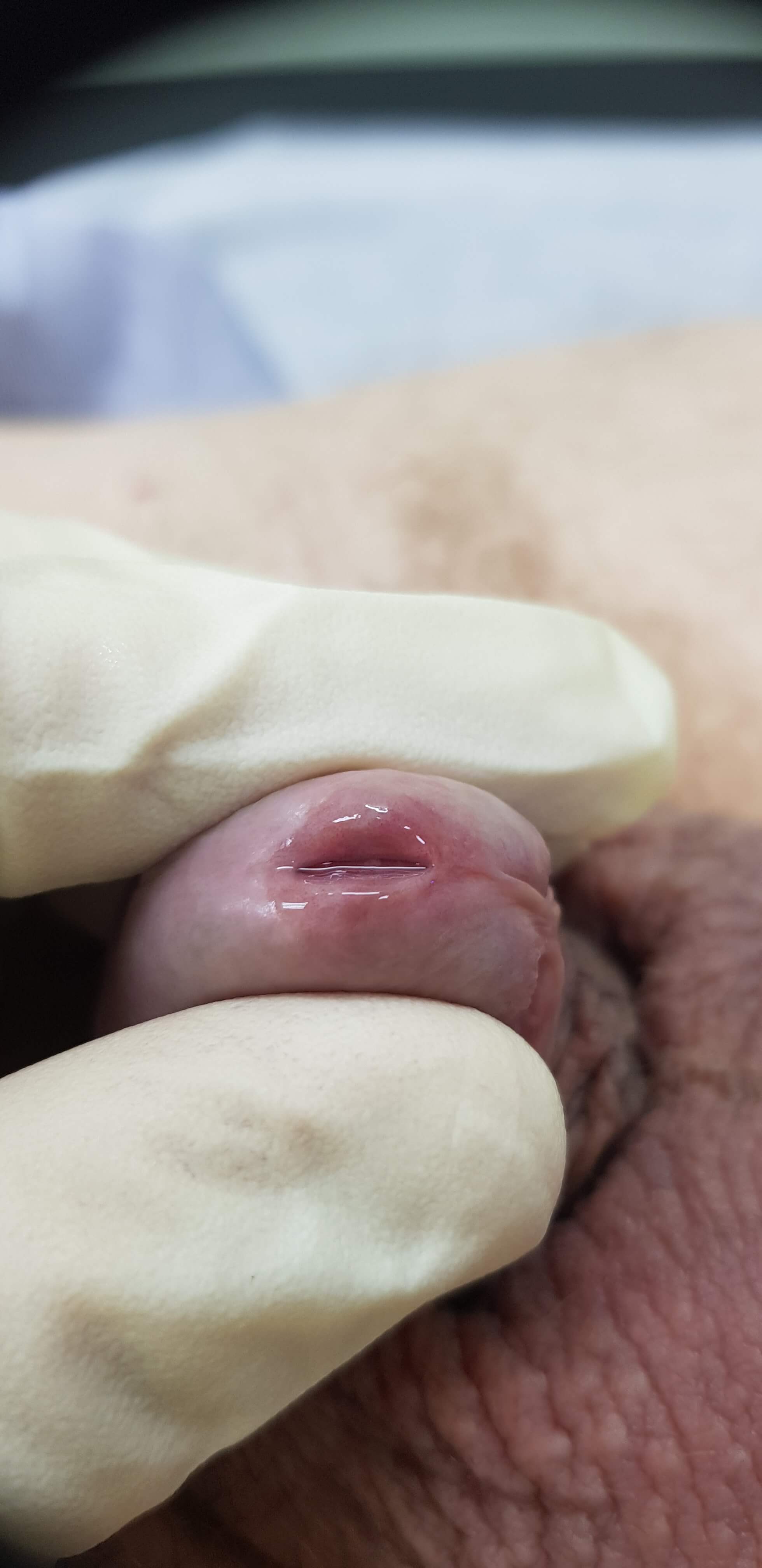 Полиморфизм микоплазмы