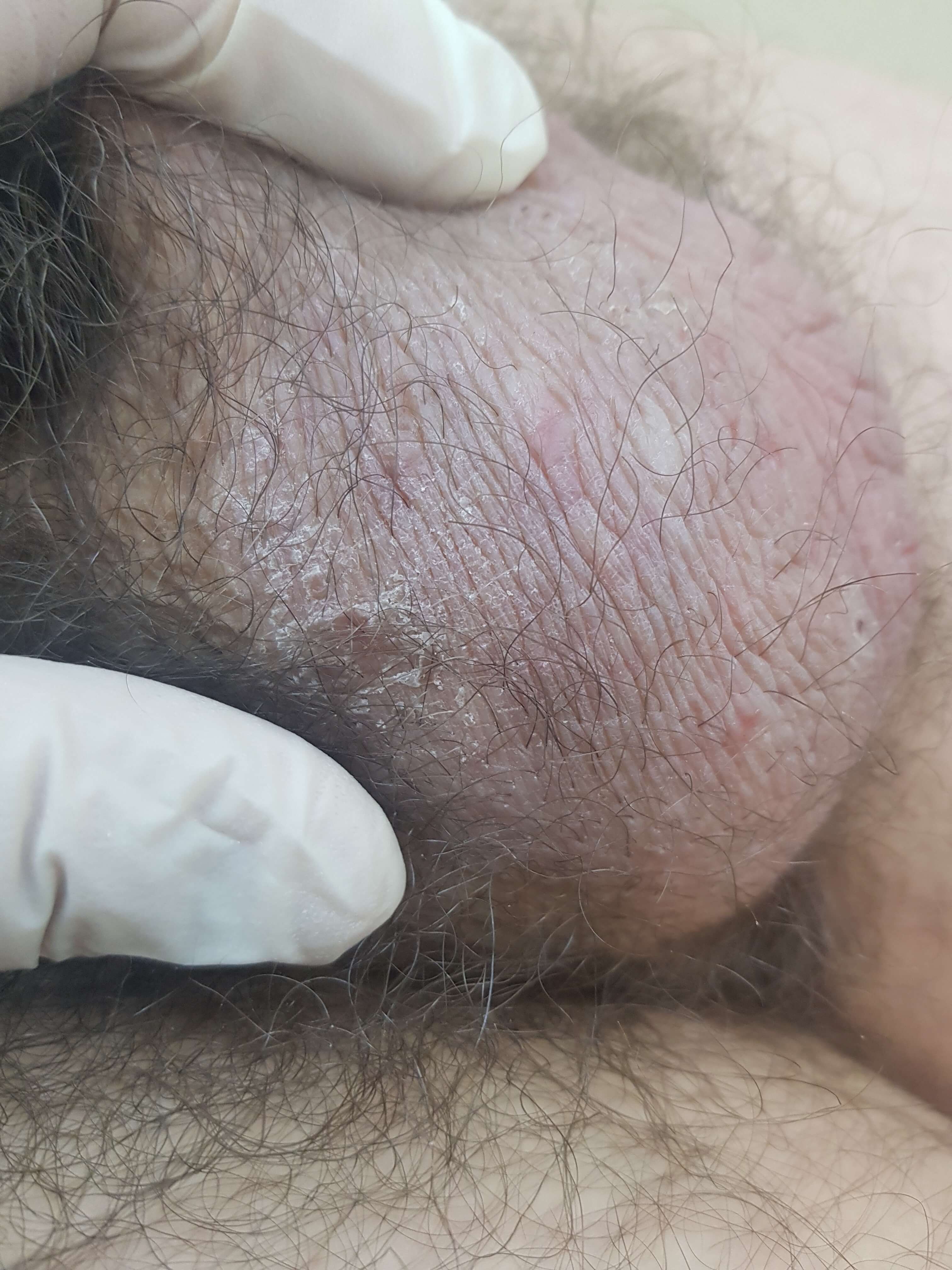 высокая температура