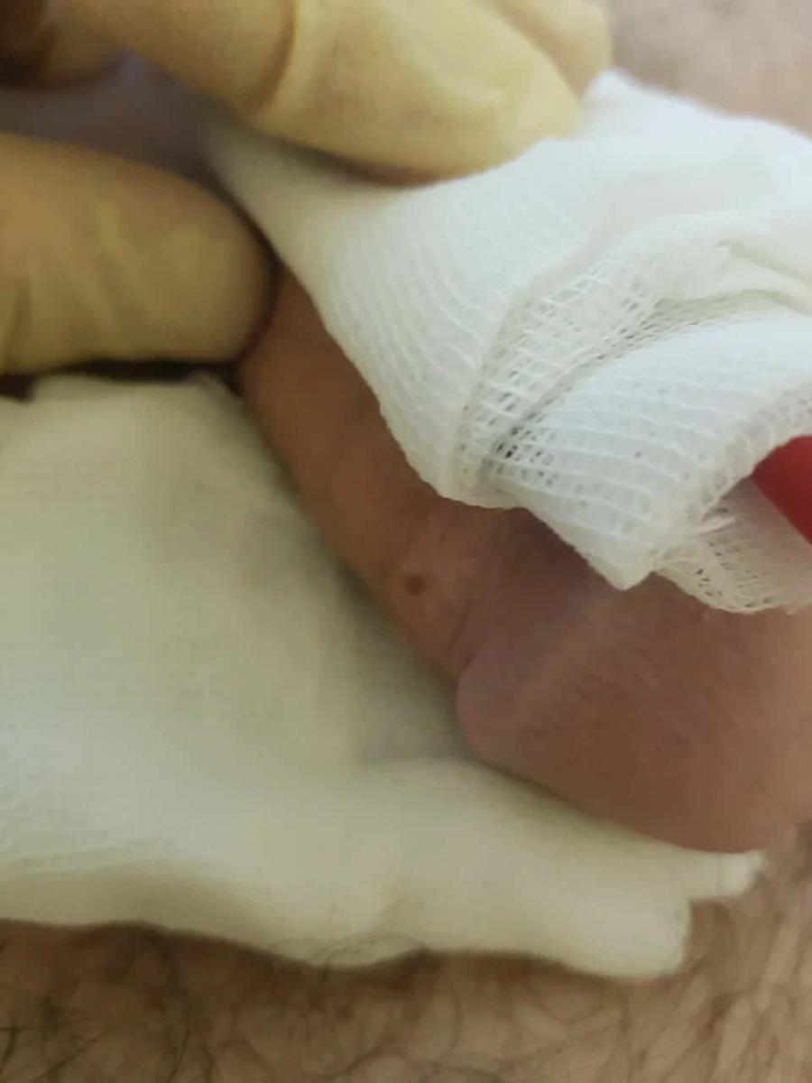 электрофорез