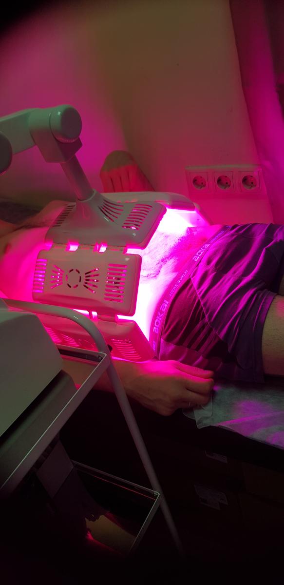 фолликулит кожи живота