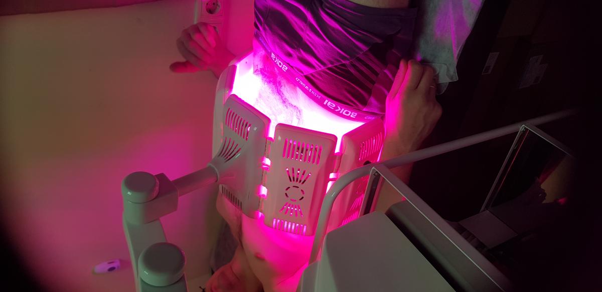 фотодинамическая терапия фдт