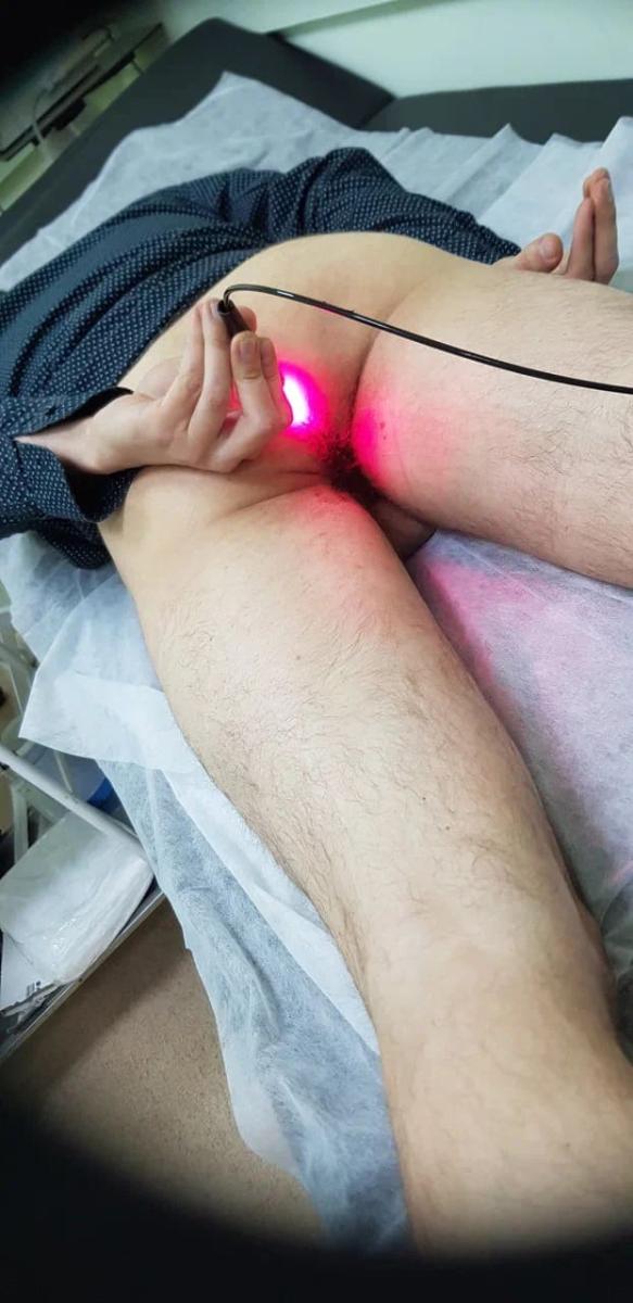 фотодинамический лазер фотодинамический лазер