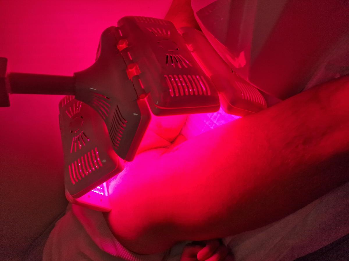 фотодинамическая терапия при зуде в межъягодичной складке фдт