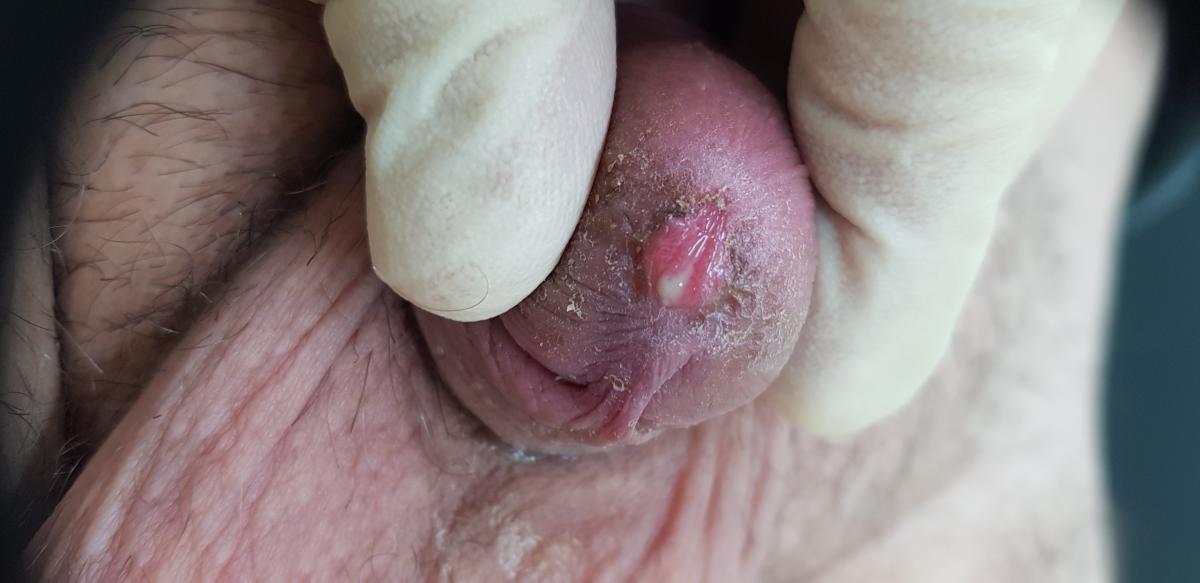 Болезненность внизу живота