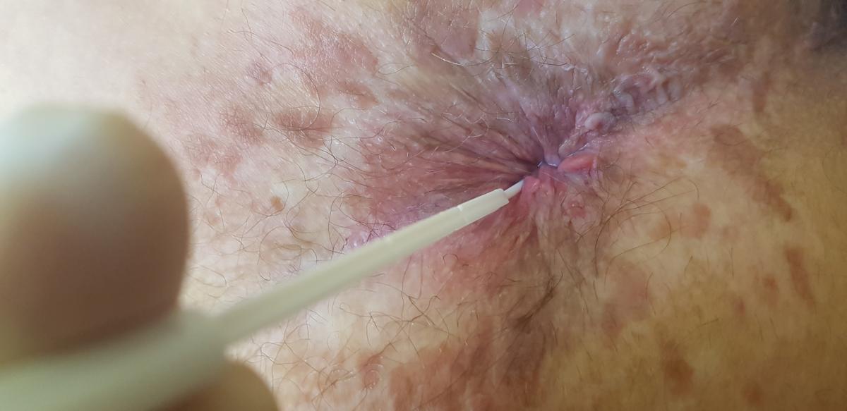 Пациент на приеме венеролога