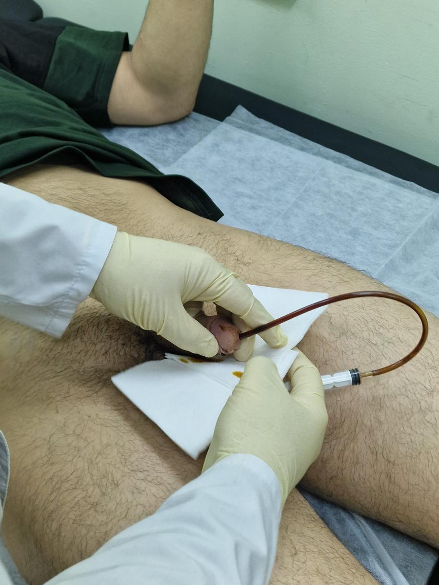 инстилляция