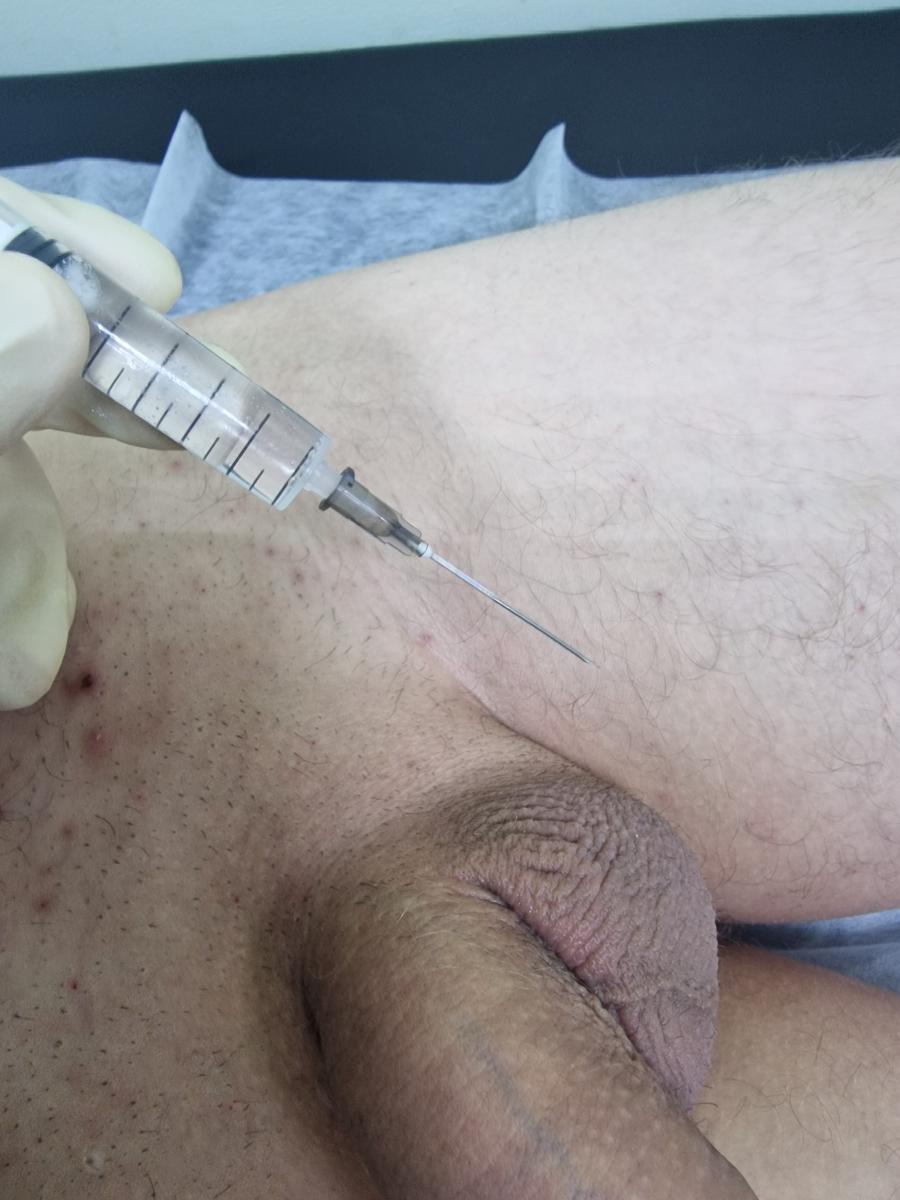 лимфотропная терапия лимфотроп