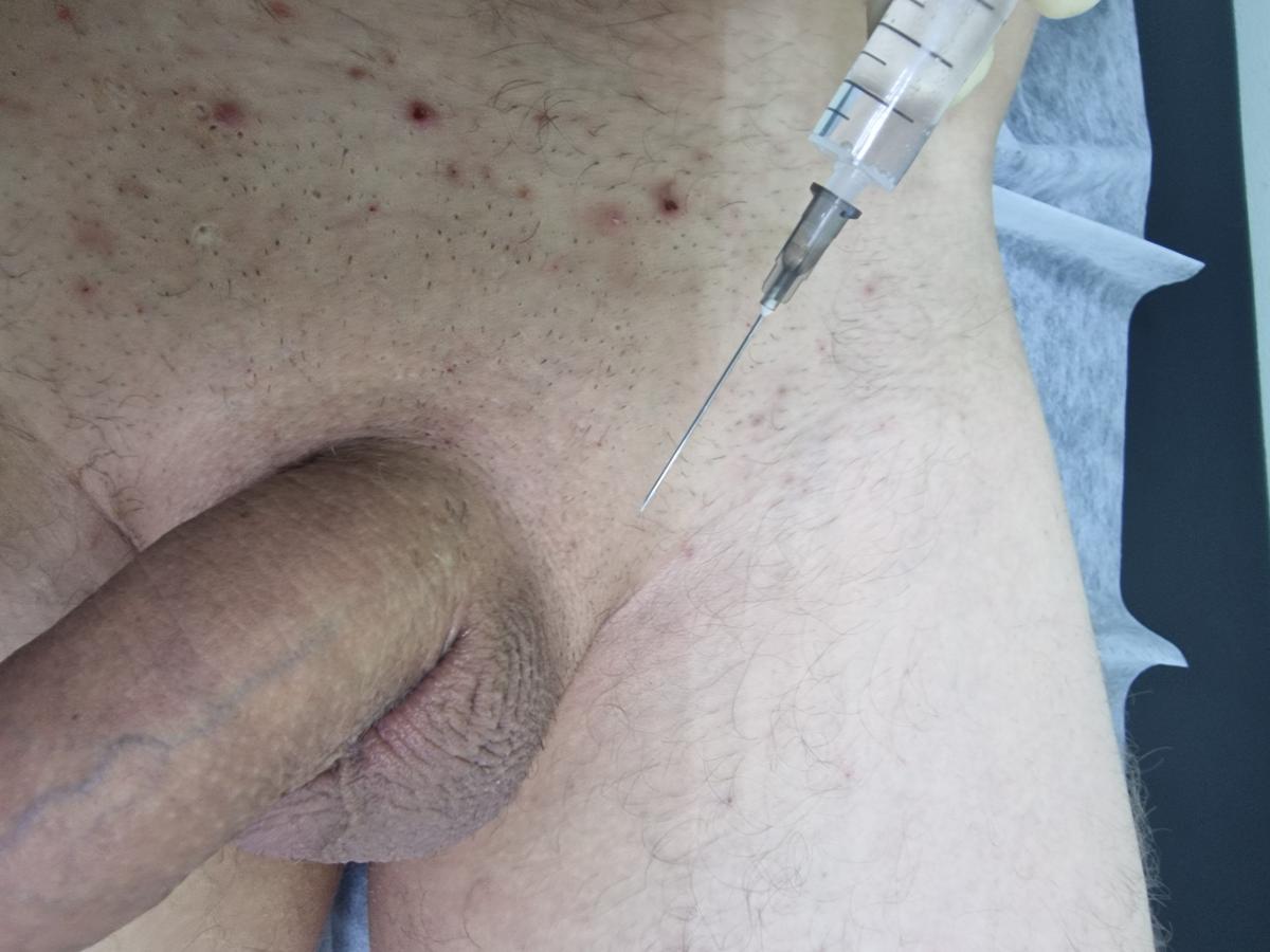 лимфотропное