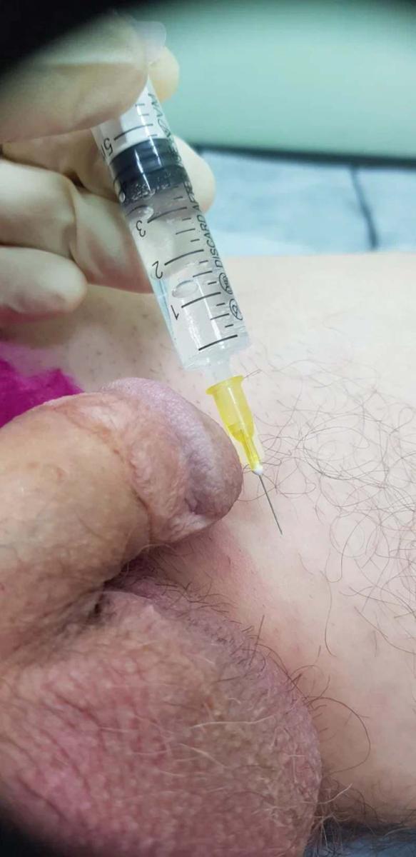 Лимфотропное введение