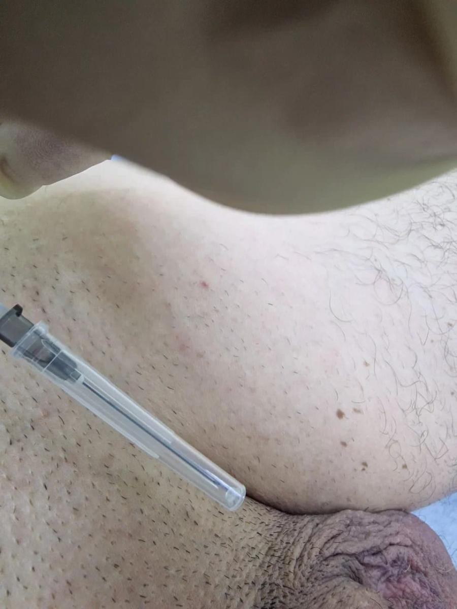 Лимфотропное введение
