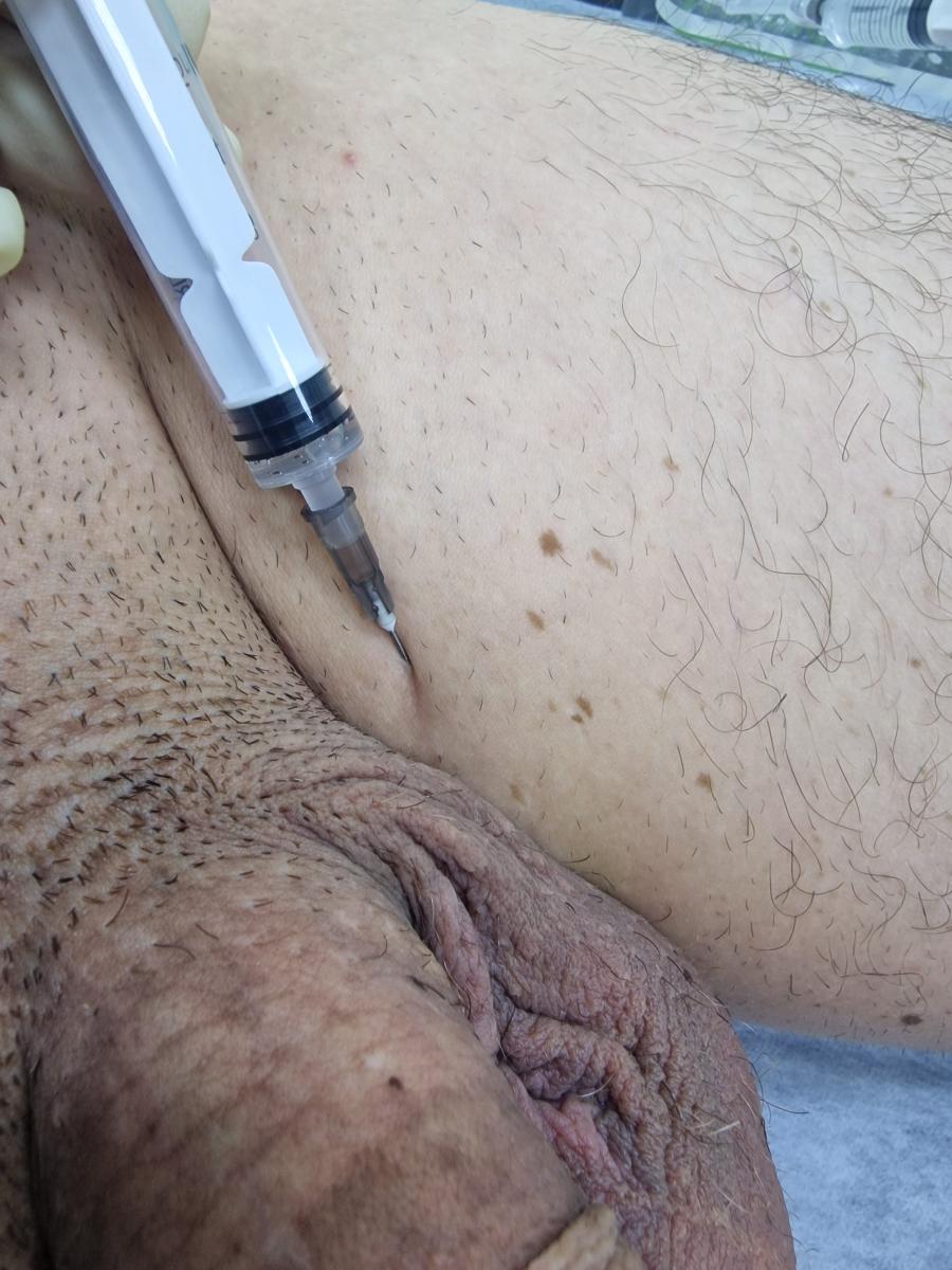 лимфотропка