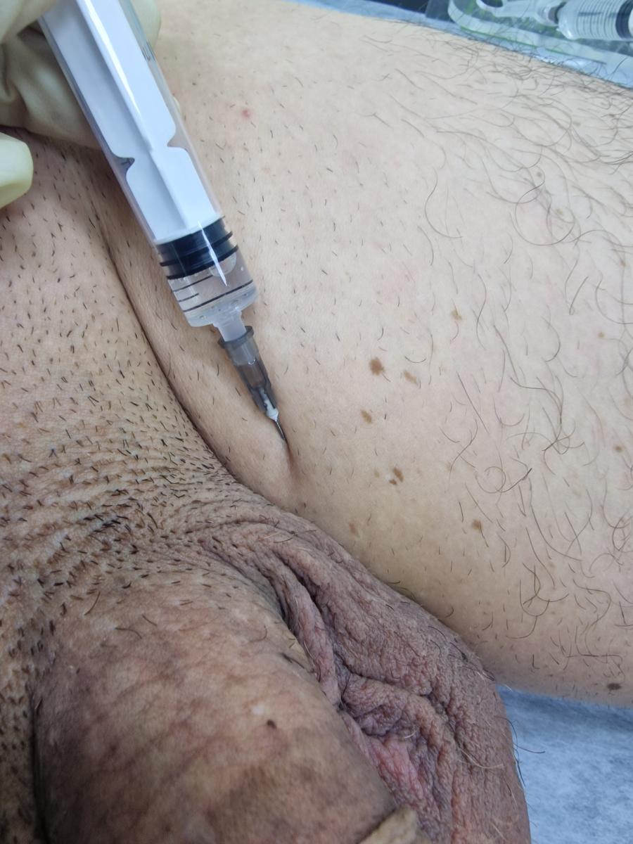 лимфотропная терапия лимфотропка