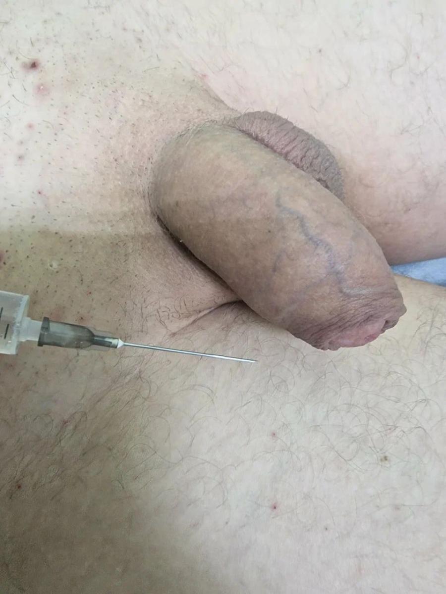 Лимфотропное введение