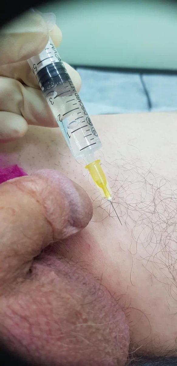 Лимфотропное введение