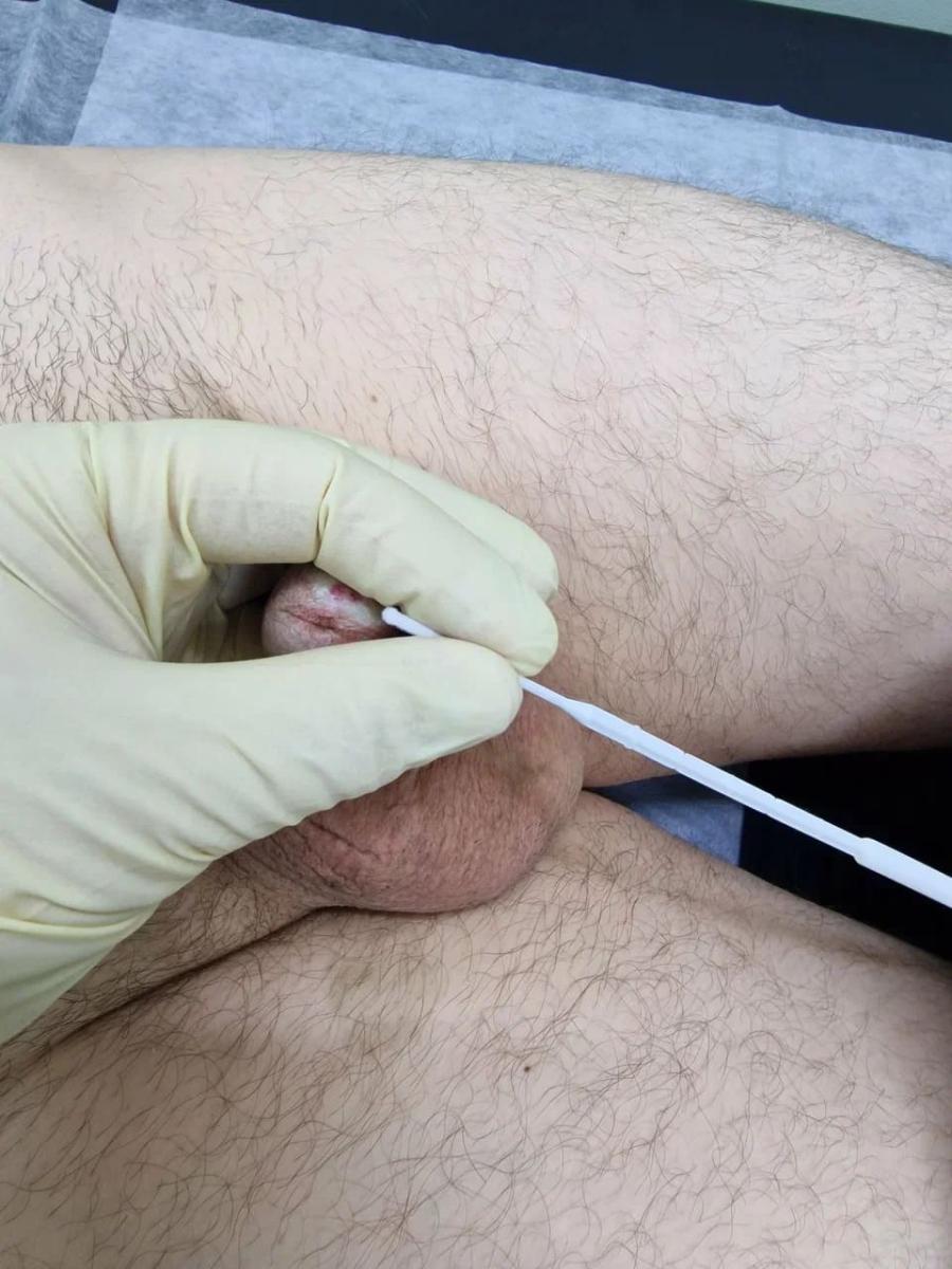 мазок из уретры