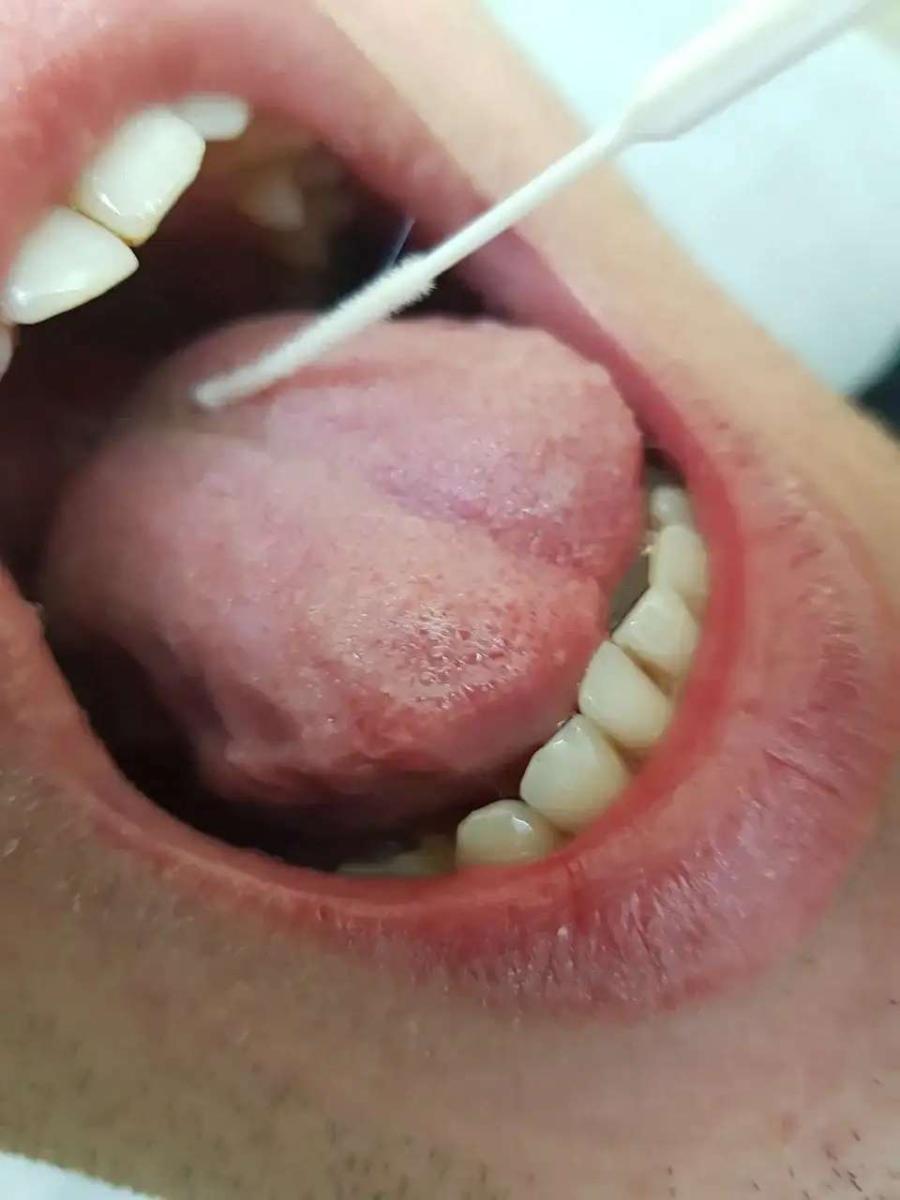 мазок изo рта мазок изo рта