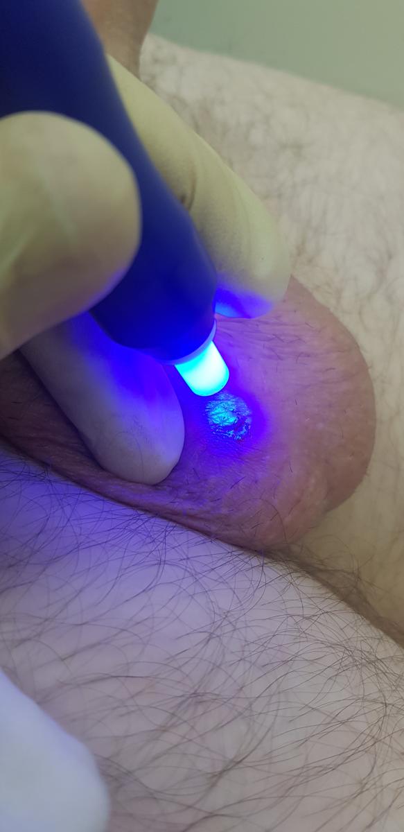 оксид азота