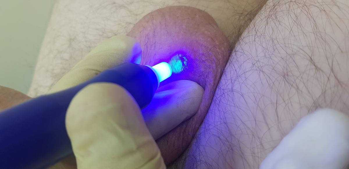 оксид азота