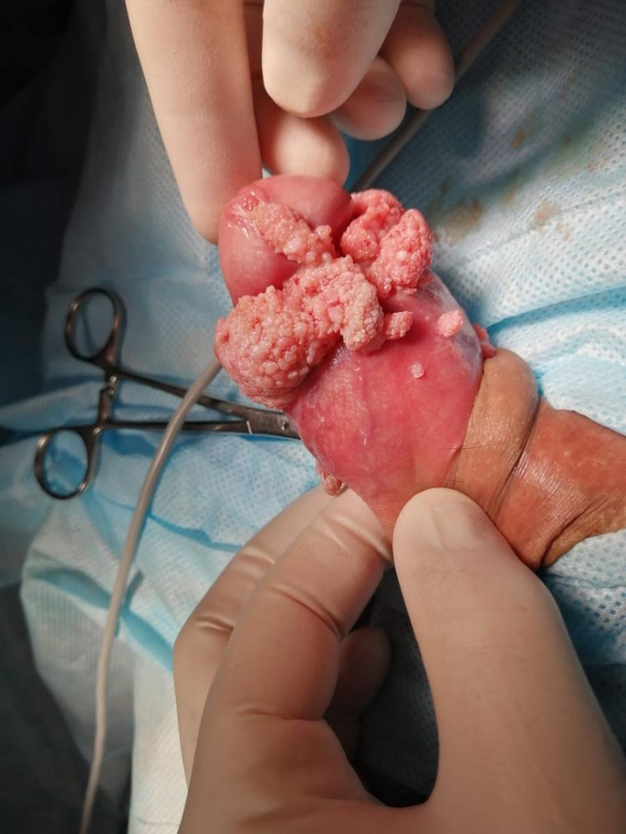 до удаления