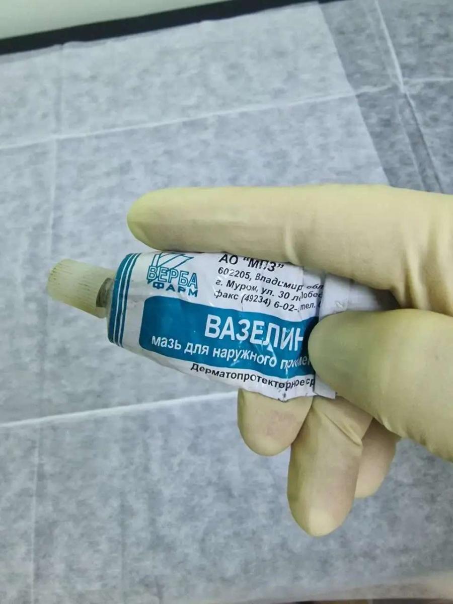 соскоб на инфекции Анализы секрета простаты и спермы