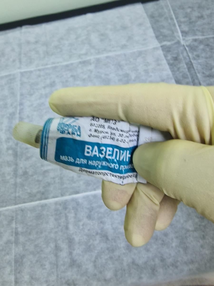 взятие секрета простаты аналих секрета простаты