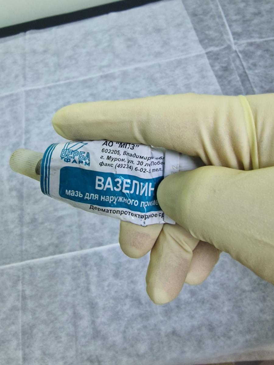 подготовка к забору секрета простаты секрет простаты