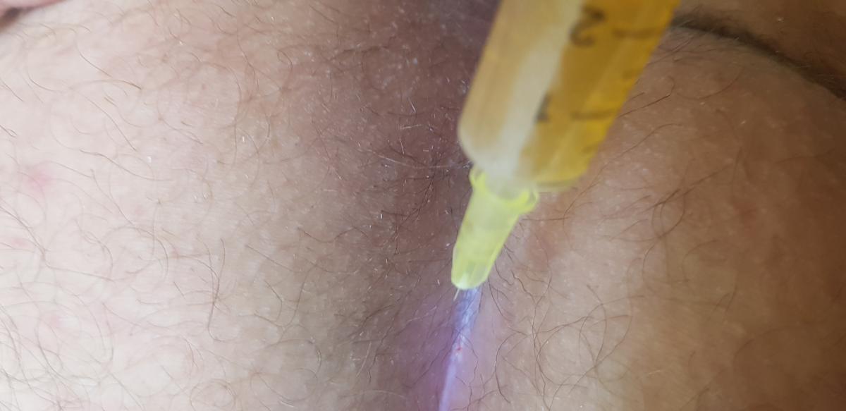 холодная плазма