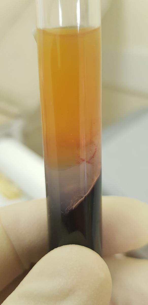 плазма крови