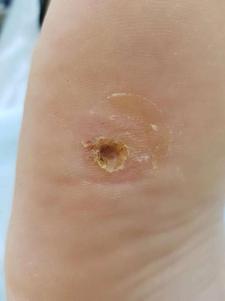 после операции