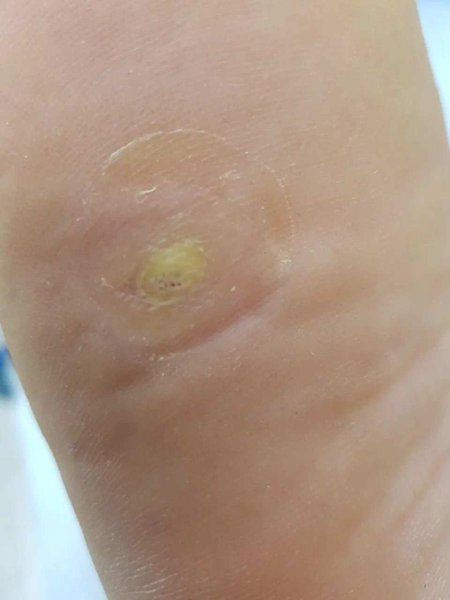 до операции