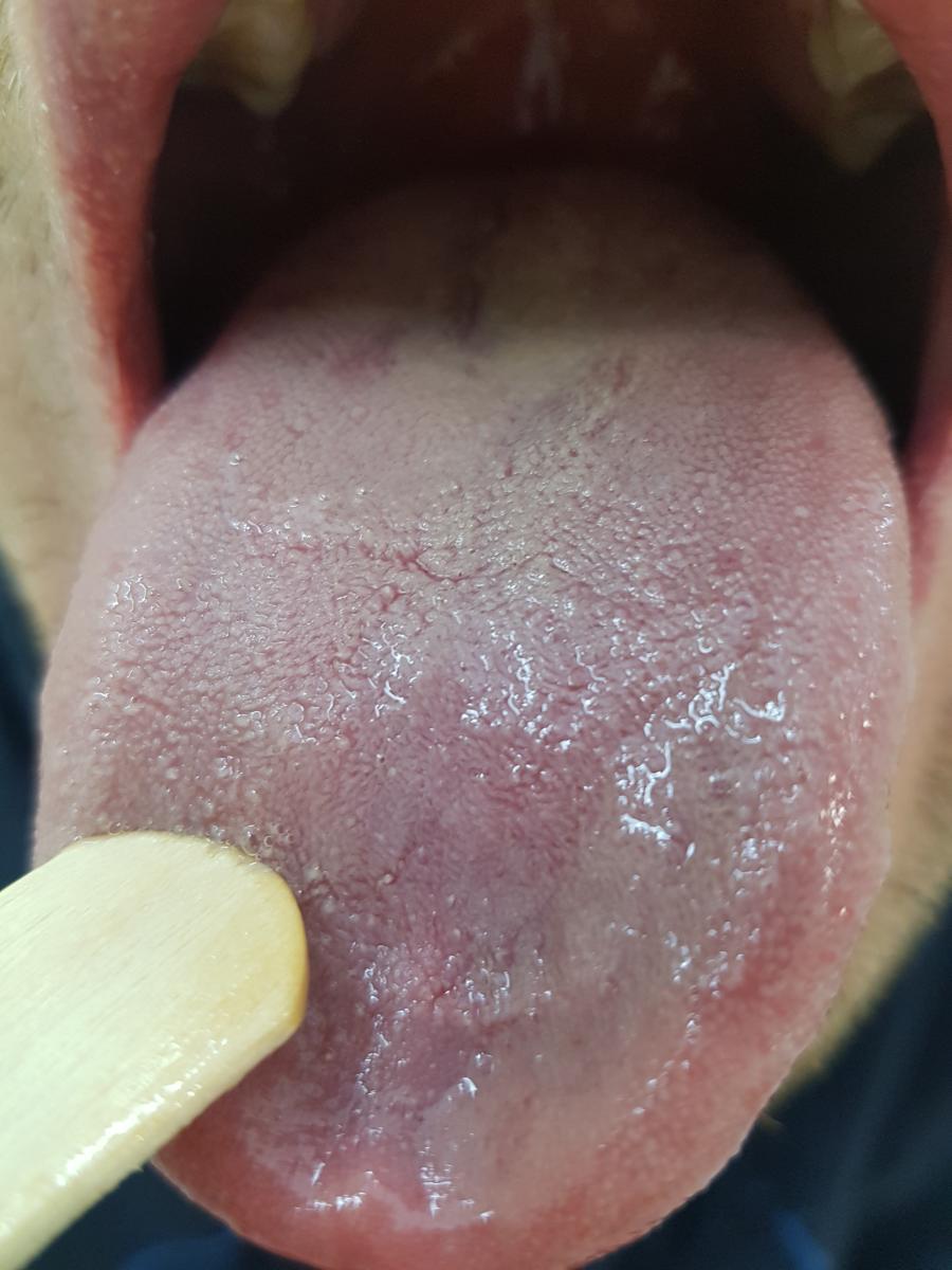 после лечения