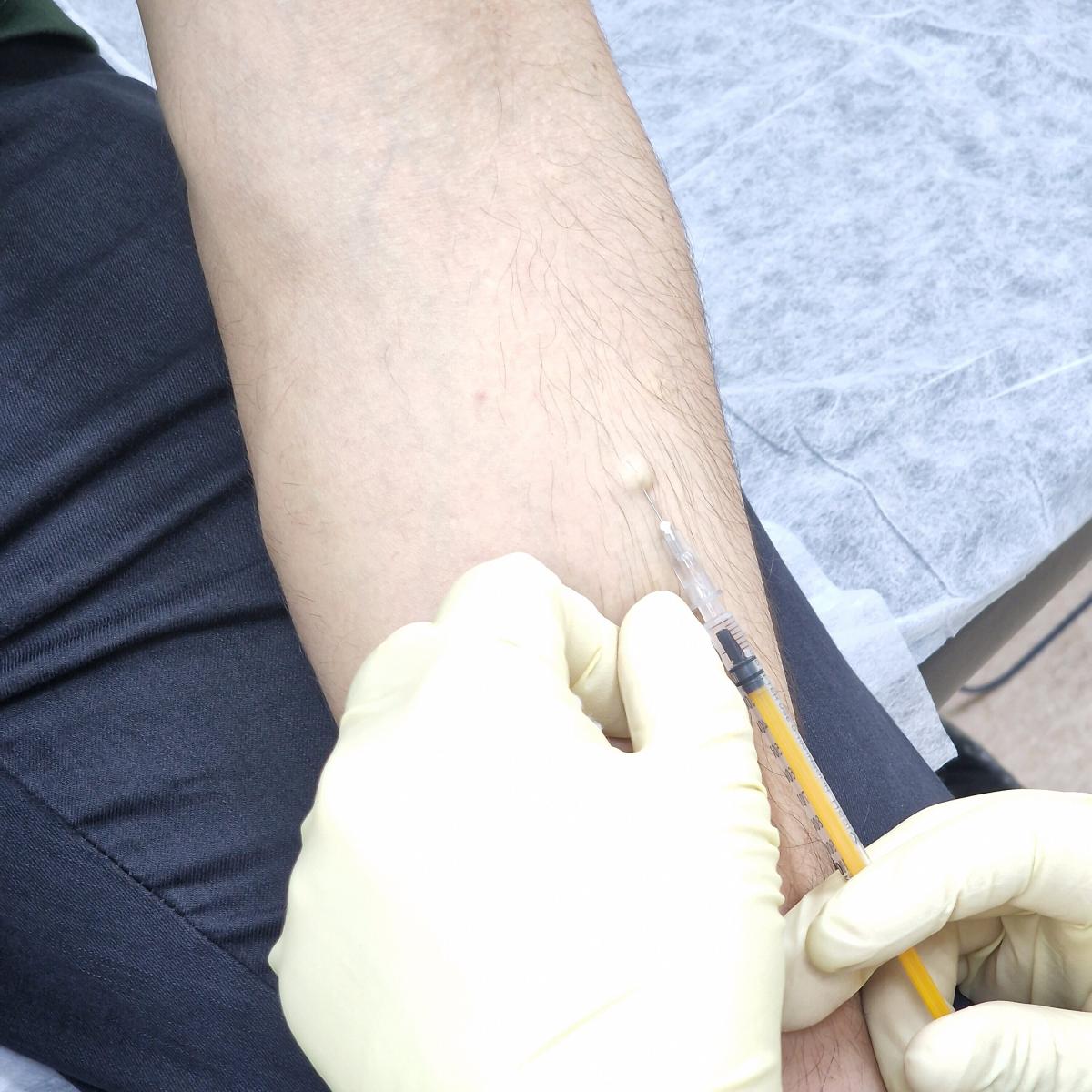 вакцина от ВПЧ 16 прививка от ВПЧ 16