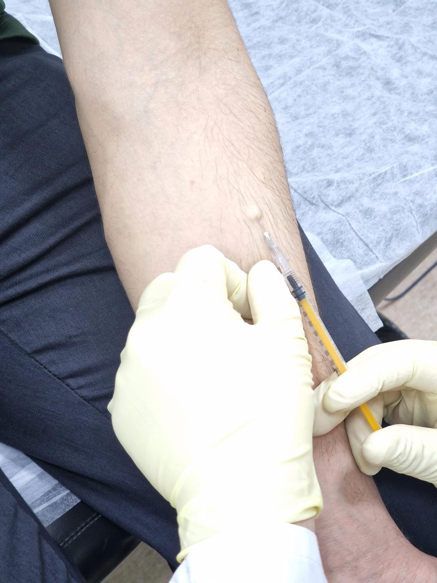 вакцинация от герпеса прививка