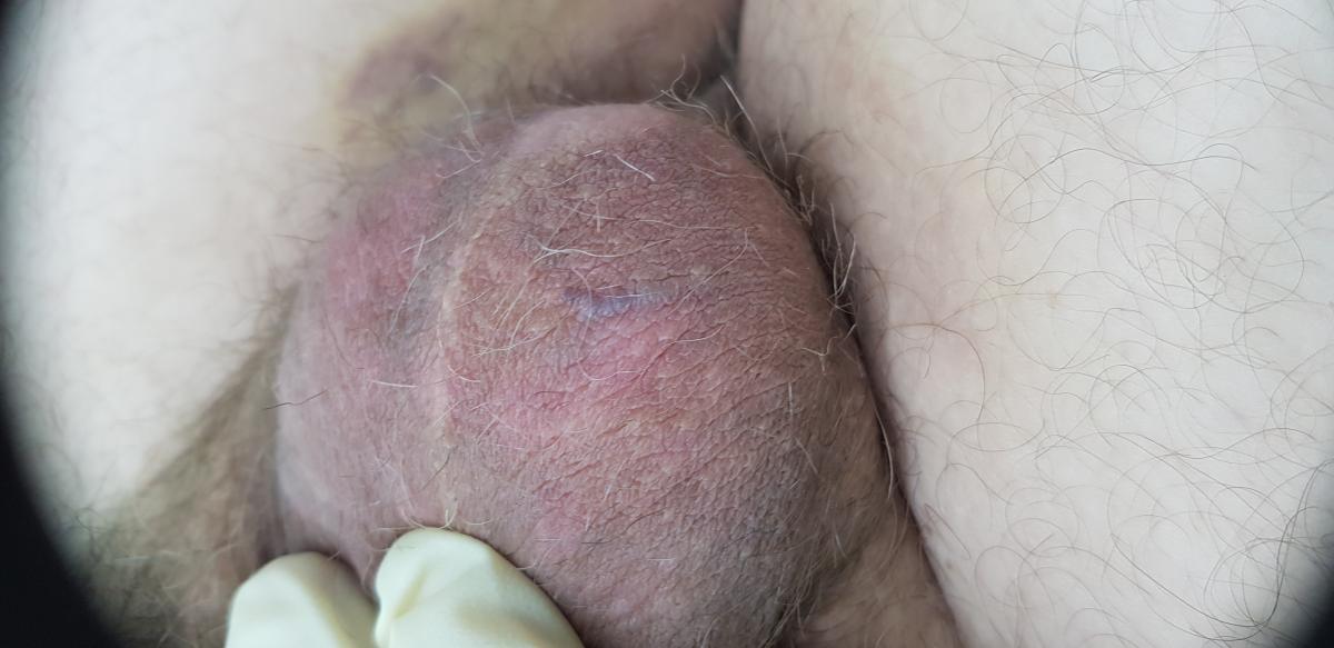 результаты