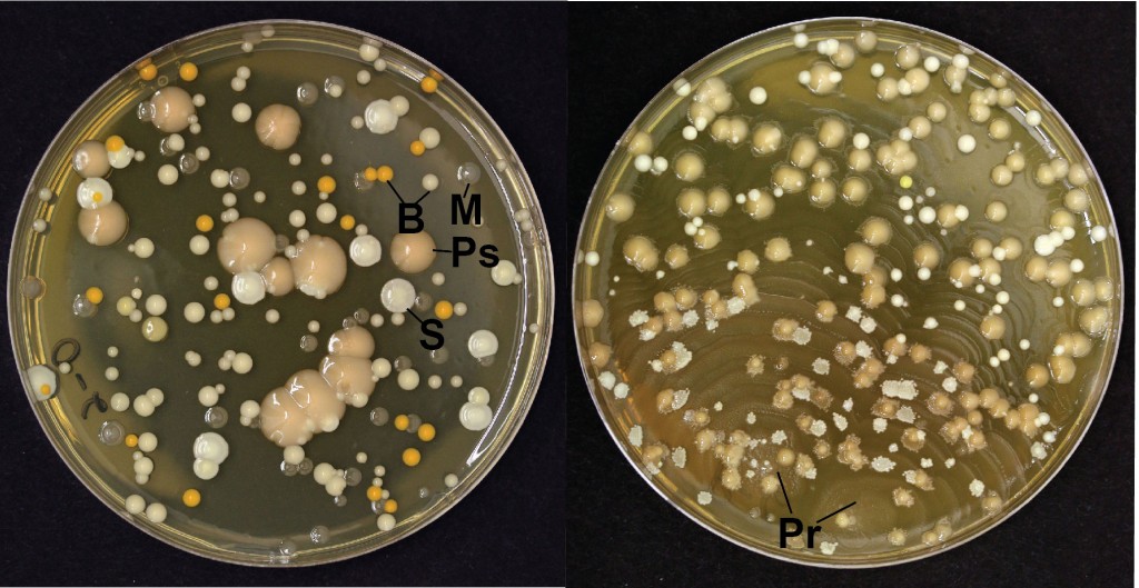 Колонии бактерий ИППП на питательной среде