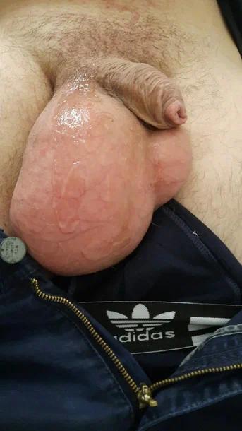 рак яичка рак яичка