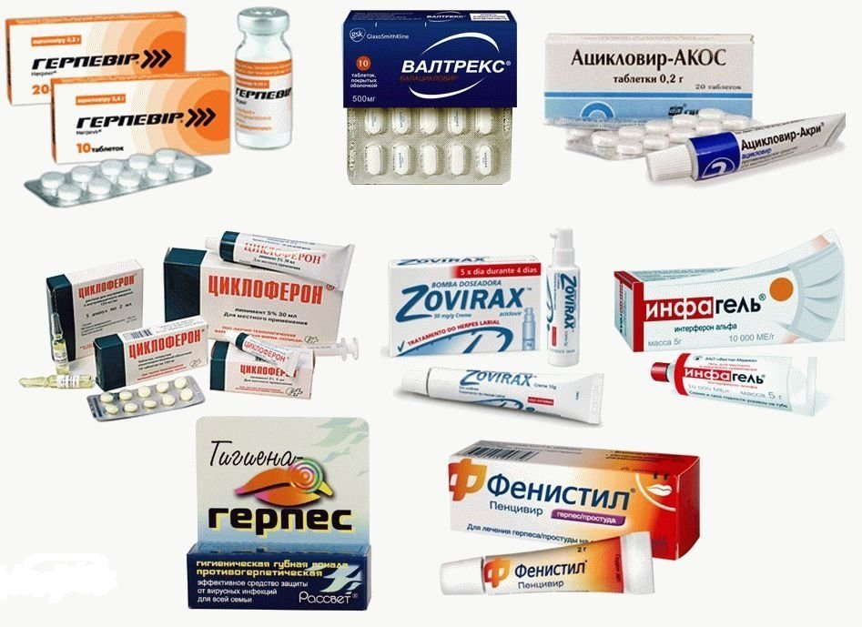 Антивирусные препараты для лечения герпеса 2 типа