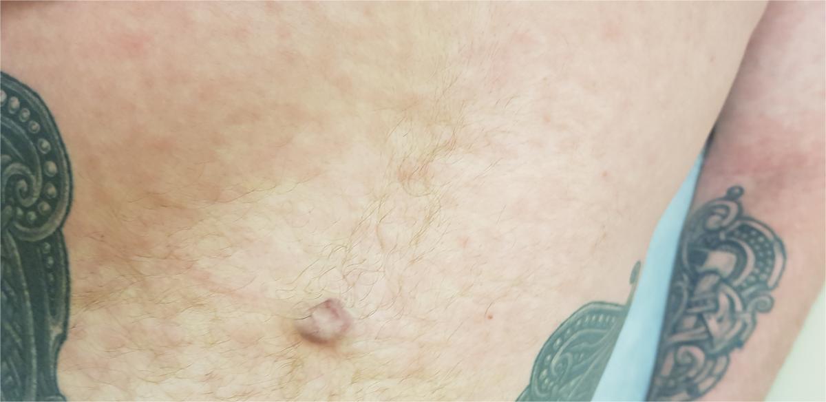 симптомы на теле