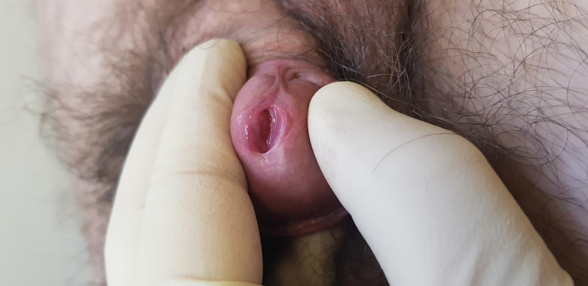 Запах и налет на члене